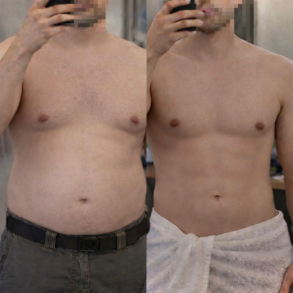 Finn's transformation, before and after