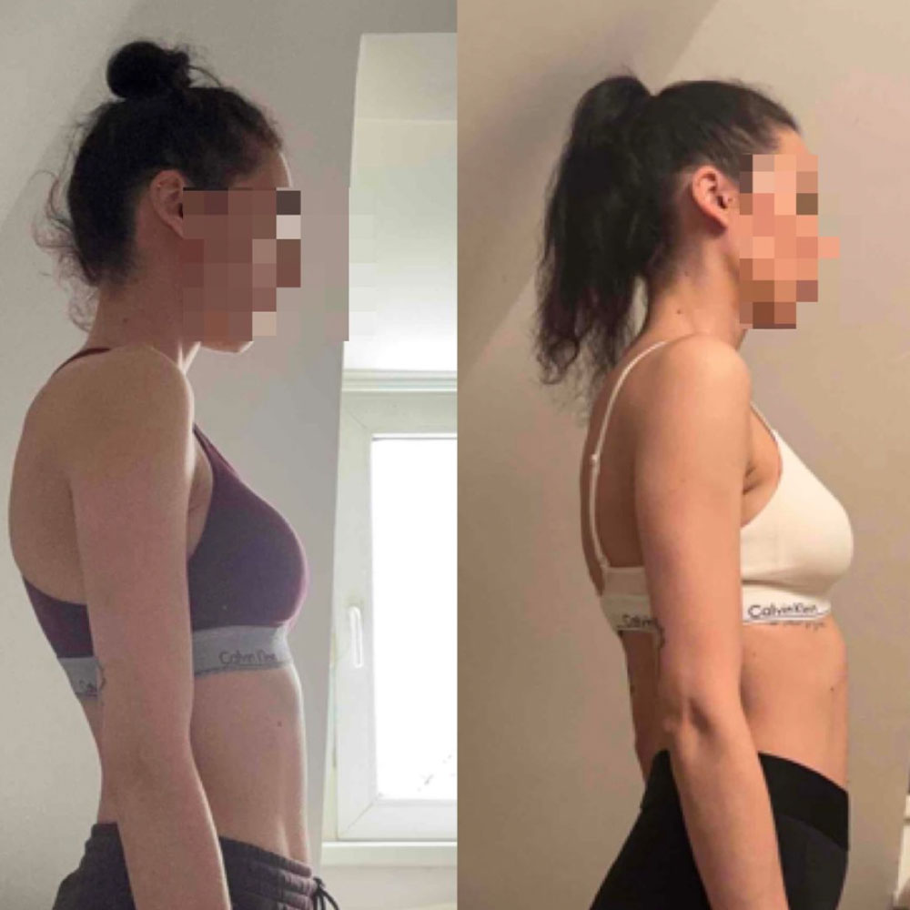 Una's transformation, before and after