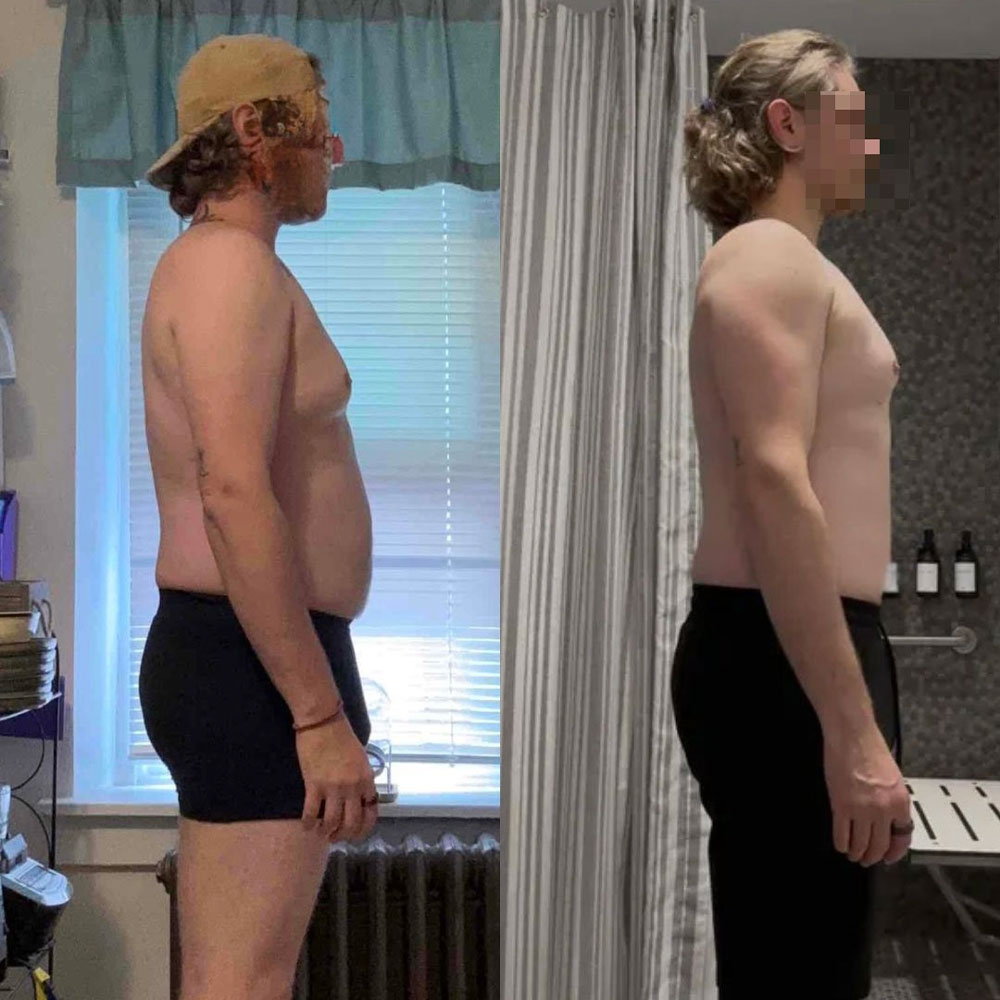 Shane's transformation, before and after
